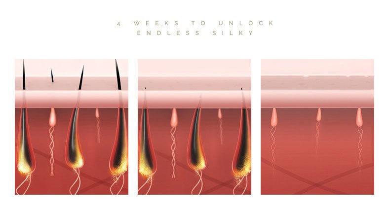 IPL Laser Hair Removal Device - Quick ShopBeauty & Personal Care