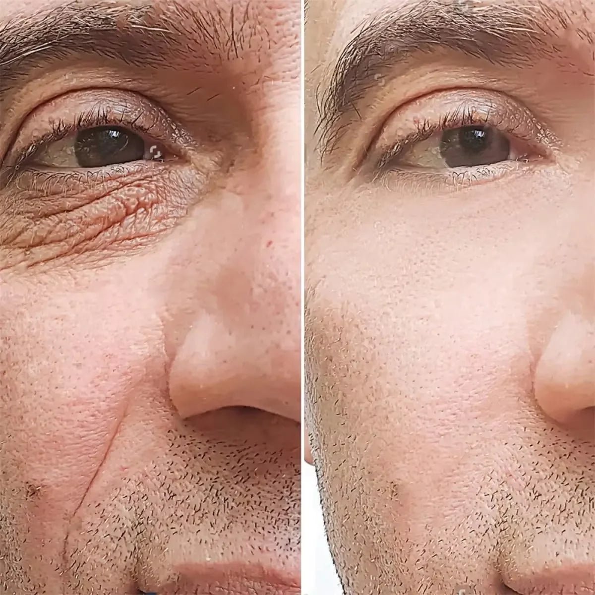 Retinol Anti-Wrinkle Cream for Men - Quick ShopBeauty & Personal Care
