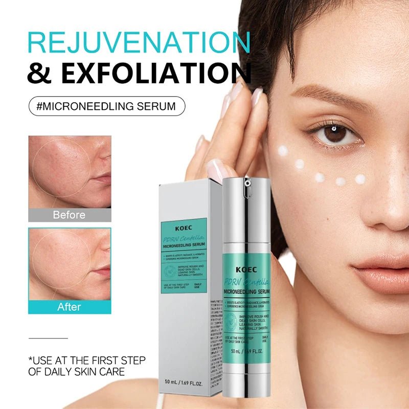 Spicule Microneedling Serum — Korean Glass Skin Booster - Quick ShopBeauty & Personal Care